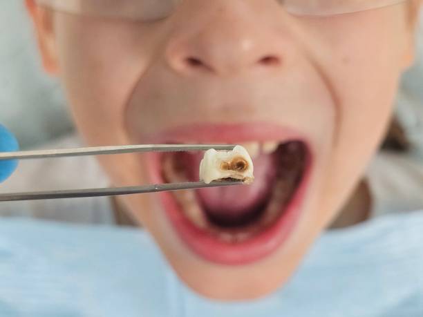 Best Tooth Infection Emergency Dentist  in Kearny, AZ